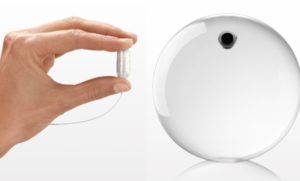 obalon-balloon-treatment-1