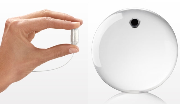 obalon-balloon-treatment-1