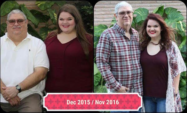 John and Sydney Before and After Weight Loss Surgery