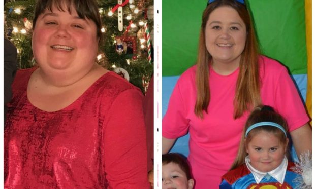 Michelle_DeCarrie_TLC_Surgery_before_after