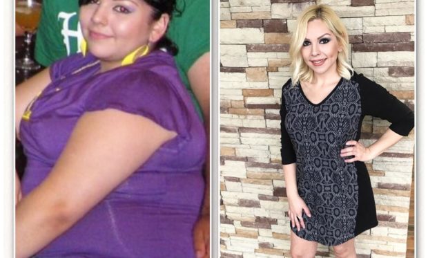 TLC_Surgery_Houston_Weight_Loss_Success_Story_Esmeralda