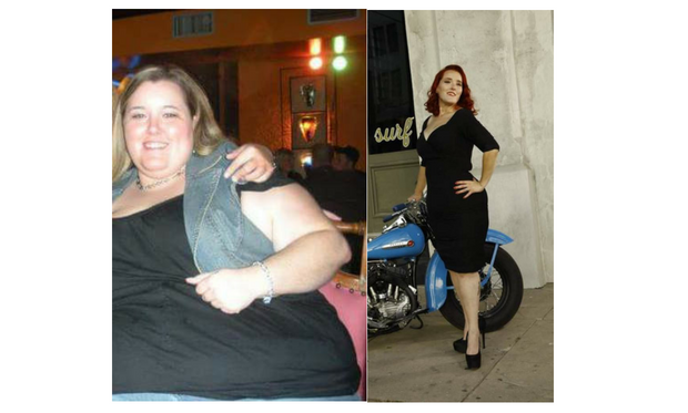 Brandi_TLC_Surgery_Patient_Success_Story