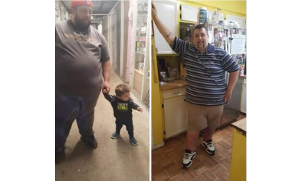 Joseph_Patient_Before_After_TLC