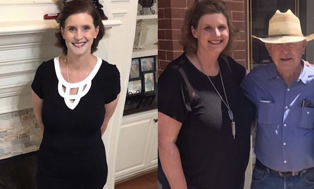TLC Surgery WLS Success Story Kristi