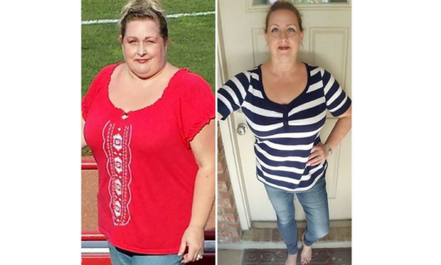 Krista Patient Story