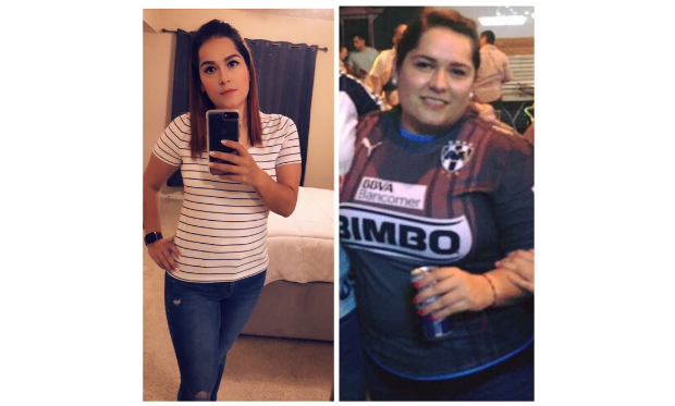 TLC_Surgery_Patient_Success_Story_Patricia