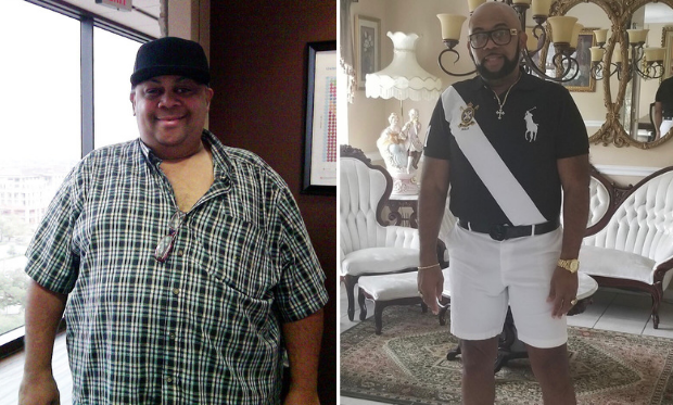 Arthur's TLC Surgery Patient Success Story