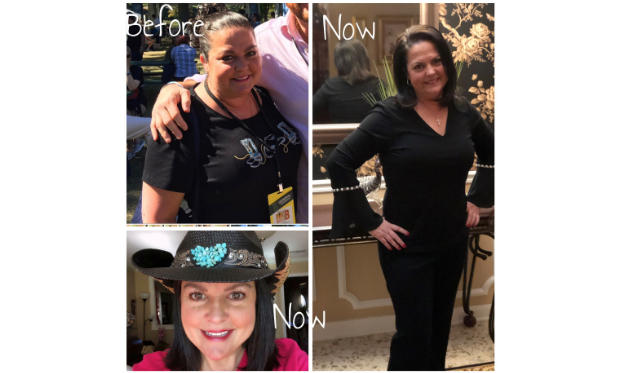 TLC-Surgery-Patient-Success-Story-Teresa